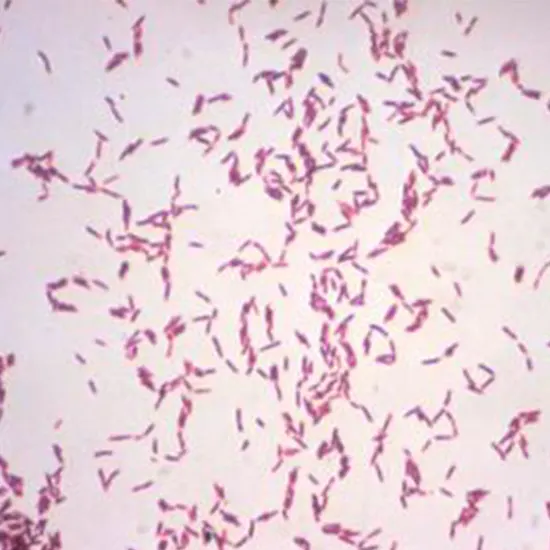 Don't Underestimate The Power Of Aranobacterium Hemolyticum Navigating Through Dangerous Bacterial Species